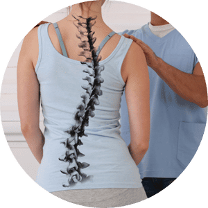 Rehab Core Physical Therapy - How to detect a Scoliosis and what to do if  you identify one? Scoliosis is a lateral curvature of the spine greater  than 10 degrees. When we